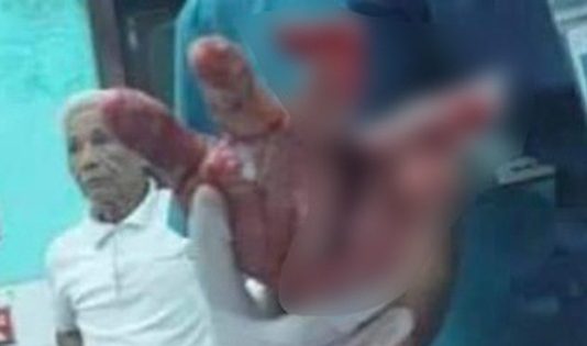 Buổi rượu ‘chào sân’ đàng gái, bạn trai 19 tuổi chém trọng thương cha và cậu bạn gái
